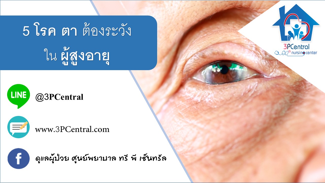 สัญญาณอันตราย 5 โรค “ตา” ที่ผู้สูงอายุควรระวัง